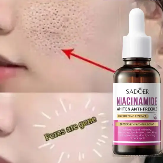 Sadoer Niacinamide White Anti-Freckle Serum